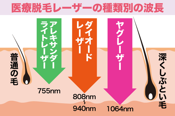 波長の長さの違いを示したイラスト